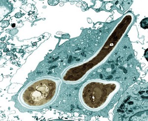 view Macrophage infected with Candida yeast spores, TEM