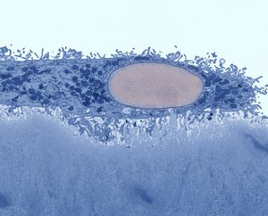 view Osteoclast breaking down dentine, TEM