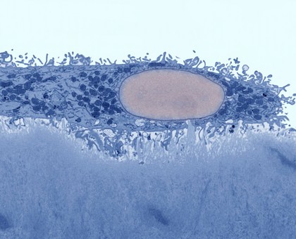 Osteoclast breaking down dentine, TEM