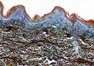 view Human skin section, histology