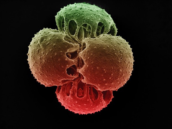 Venus flytrap pollen grains, SEM