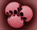 view Venus flytrap pollen grains, SEM
