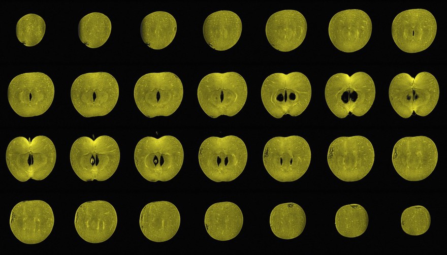 Apple, sagittal view, MRI