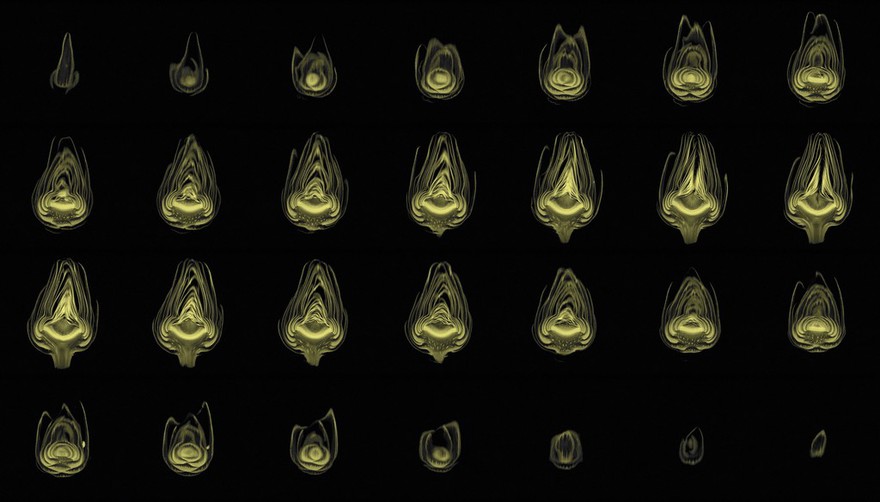 Artichoke, sagittal view, MRI