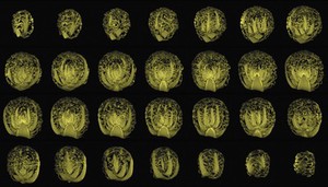 view Cabbage, sagittal view, MRI