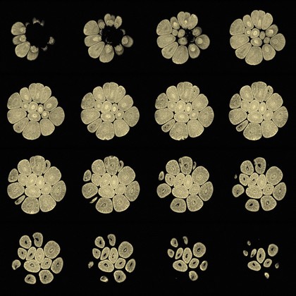 Garlic, axial view, MRI