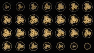 view Granadilla, axial view, MRI