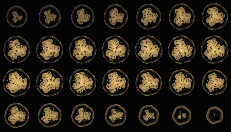 Granadilla, axial view, MRI