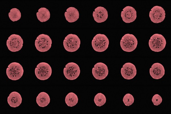 Guava, axial view, MRI