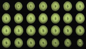 view Kiwi, axial view, MRI