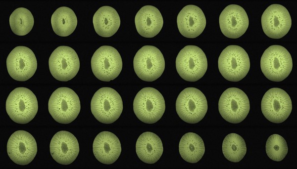 Kiwi, axial view, MRI