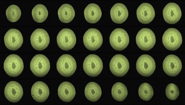 Kiwi, axial view, MRI