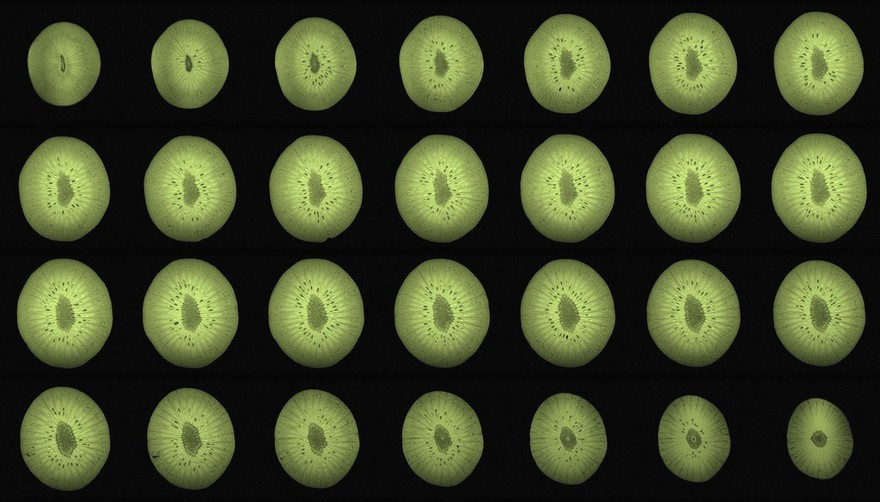 Kiwi, axial view, MRI