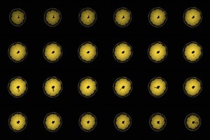 view Lemon, axial view, MRI