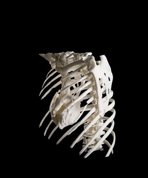 view Heart in ribcage, Hodgkin lymphoma patient, 3D printed nylon