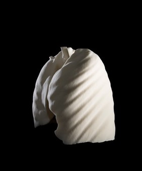 Lungs, Hodgkin lymphoma patient, 3D printed nylon