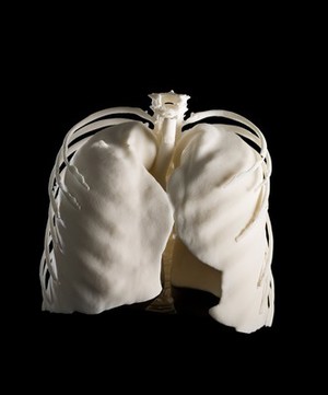 view Lungs in ribcage, Hodgkin lymphoma patient, 3D printed nylon