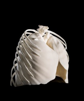 Lungs in ribcage, Hodgkin lymphoma patient, 3D printed nylon