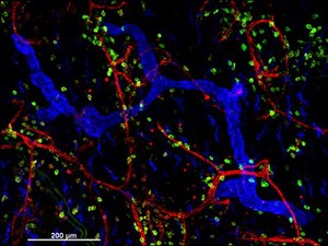 view Cellular architecture of normal human skin imaged by whole mount tissue microscopy. Human skin has a rich network of white blood cells (specifically dendritic cells, T cells and macrophages) which form sheaths around blood vessels. In this image, blood vessels (string-like structures stained for CD31; red), lymphatic vessels (ribbon-like structures stained for LYVE-1; blue) and dendritic cells (stained for CD11c; green) can be seen. Macrophages (stained for LYVE-1; blue) are also present. This normal cellular architecture is grossly disrupted in diseased skin (see related images). X10 magnification. Scale bar (white) represents 200 micrometres.