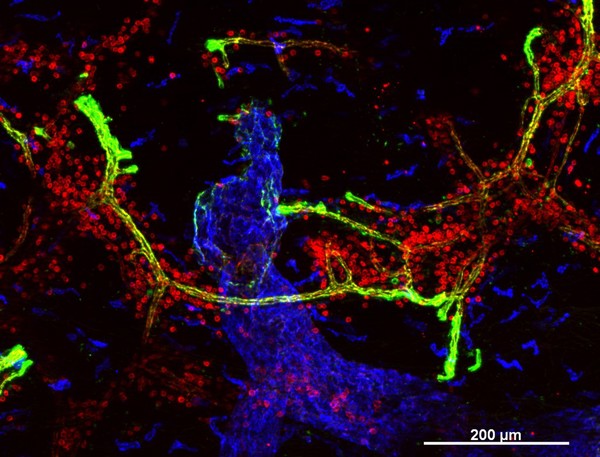 Cellular architecture of normal human skin imaged by whole mount tissue microscopy. Human skin has a rich network of white blood cells (specifically dendritic cells, T cells and macrophages) which form sheaths around blood vessels. In this image, blood vessels (string-like structures stained for CD31; green), lymphatic vessels (ribbon-like structures stained for LYVE-1; blue) and T cells (stained for CD3; red) can be seen. T cells are only found around dermal blood vessels. Macrophages (stained for LYVE-1; blue) are also present. This normal cellular architecture is grossly disrupted in diseased skin (see related images). X10 magnification. Scale bar (white) represents 200 micrometres.
