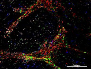 view Cellular architecture of normal human skin imaged by whole mount tissue microscopy. Human skin has a rich network of white blood cells (specifically dendritic cells, T cells and macrophages) which form sheaths around blood vessels. In this image, T cells (stained for CD3; red) dendritic cells (stained for MHC class II; green) and macrophages (stained for LYVE-1; blue with some cells showing a tinge of green) can be seen. Cell nuclei have been stained with DAPI (grey). This normal cellular architecture is grossly disrupted in diseased skin (see related images). X10 magnification. Scale bar (white) represents 200 micrometres.