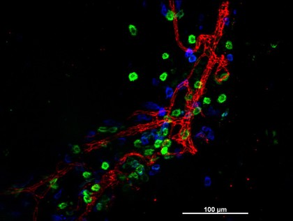 Cellular architecture of normal human skin imaged by whole mount tissue microscopy. Human skin has a rich network of white blood cells (specifically dendritic cells, T cells and macrophages) which form sheaths around blood vessels. This image was taken greater than 150 micrometres beneath the junction that joins the dermal and epidermal layers of the skin (dermo-epidermal junction). At this level, dendritic cells (stained for CD11c; green) and macrophages (stained for LYVE-1; blue) form clusters around blood vessels (stained for CD31; red). This normal cellular architecture is grossly disrupted in diseased skin (see related images). Scale bar (white) represents 100 micrometres.