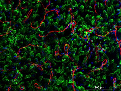 Cellular architecture of normal human skin imaged by whole mount tissue microscopy. Human skin has a rich network of white blood cells (specifically dendritic cells, T cells and macrophages) which form sheaths around blood vessels. This image was taken directly beneath the junction that joins the dermal and epidermal layers of the skin (dermo-epidermal junction). At this level, the capillary network (stained for CD31; red) is visualised against a lawn of autofluorescent dermal papillae (finger-like projections of the dermis; green) scattered with dendritic cells (stained for CD11c; green) and macrophages (stained for LYVE-1; blue). This normal cellular architecture is grossly disrupted in diseased skin (see related images). Scale bar (white) represents 200 micrometres.