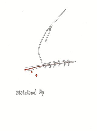 Needle and thread stitching up a wound, artwork