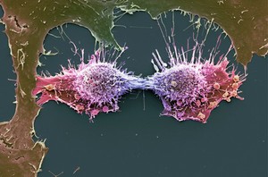 view HeLa cells, immortal human epithelial cancer cell line, SEM