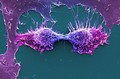 view HeLa cells, immortal human epithelial cancer cell line, SEM