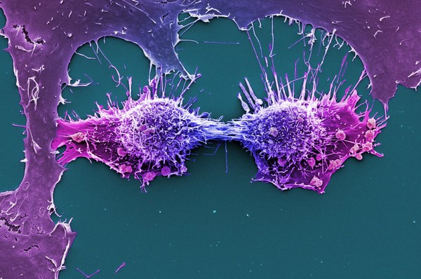 HeLa cells, immortal human epithelial cancer cell line, SEM