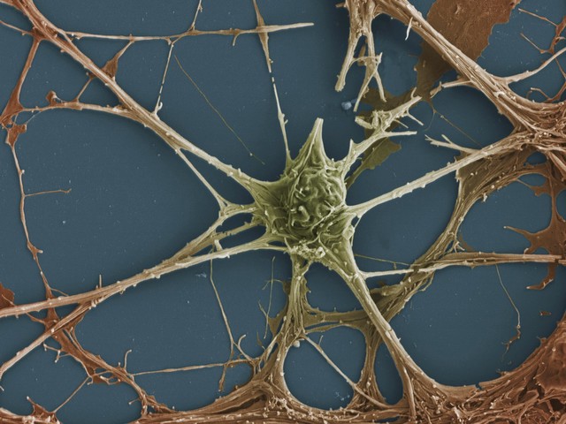 Rat neurones, SEM