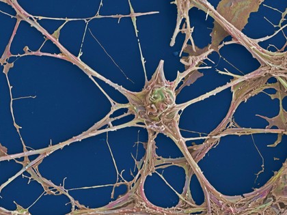 Rat neurones, SEM