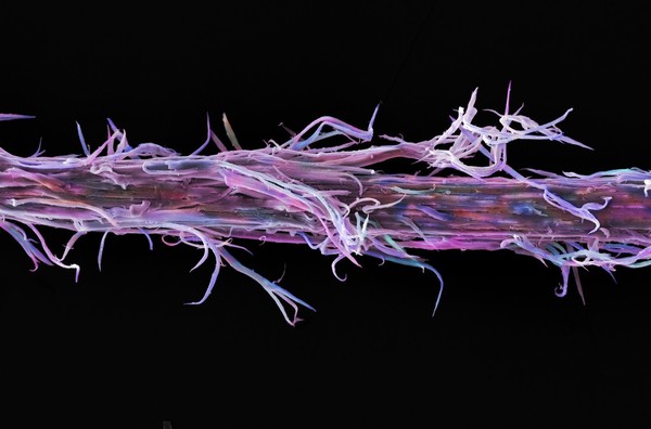 Damaged human hair, bleached and straightened, SEM