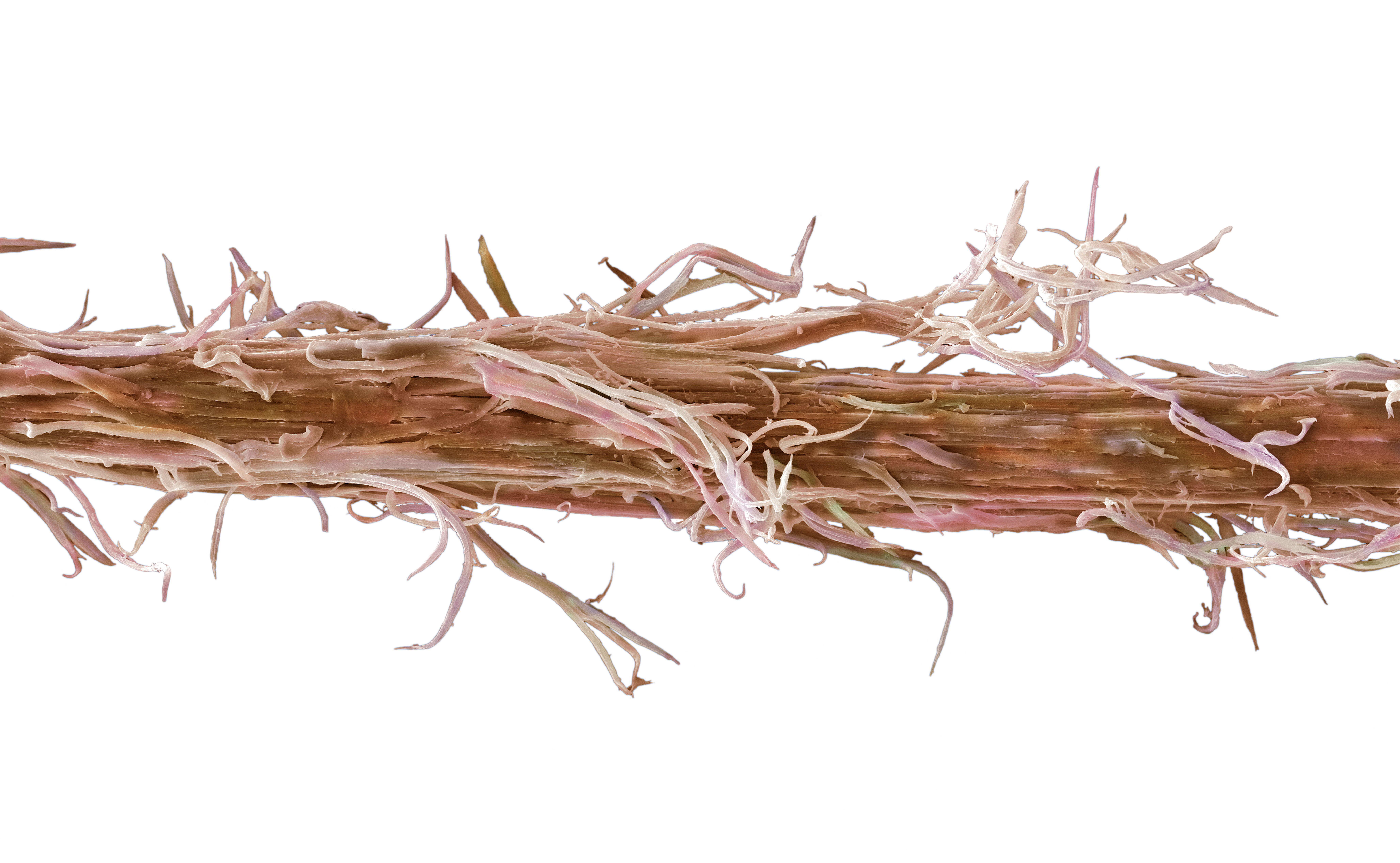 Damaged Human Hair Bleached And Straightened Sem Wellcome