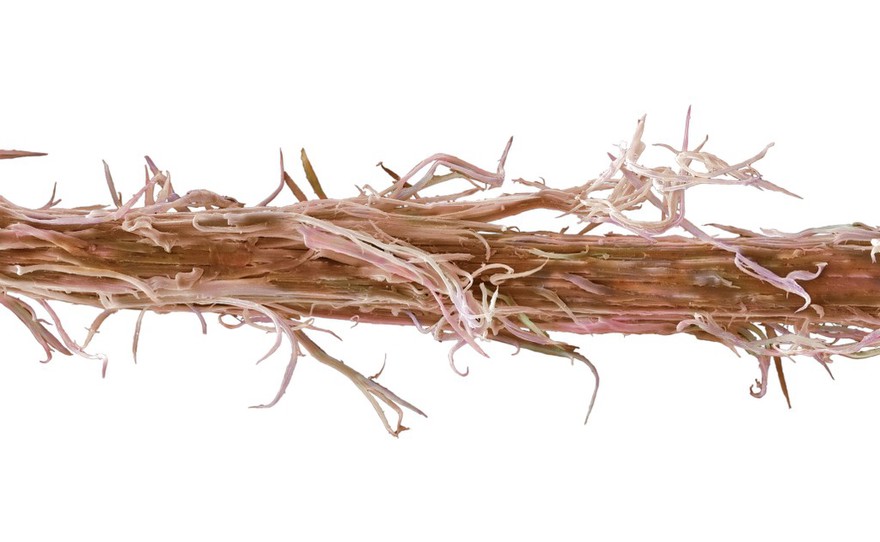 Damaged human hair, bleached and straightened, SEM