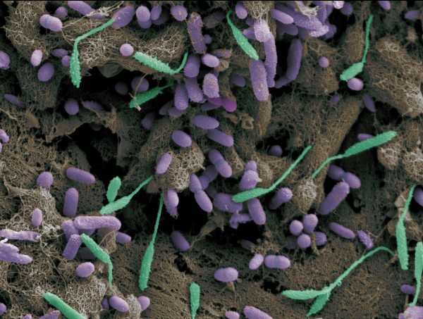 Grass seed covered in bacteria from infected dog's paw