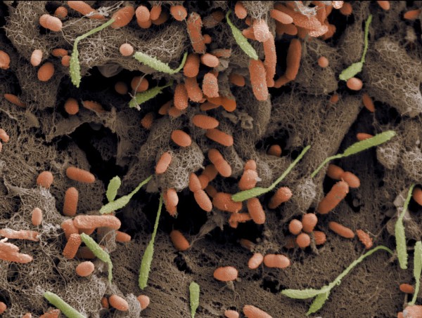 Grass seed covered in bacteria from infected dog's paw