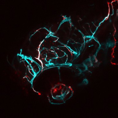 Blood vessels in the head of a zebrafish embryo