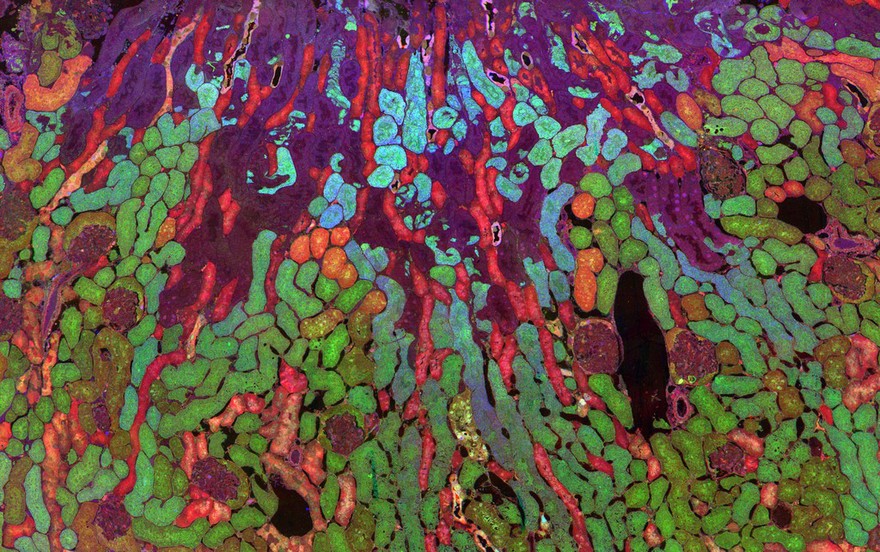 Distribution of metabolites in a mouse kidney, CMP.