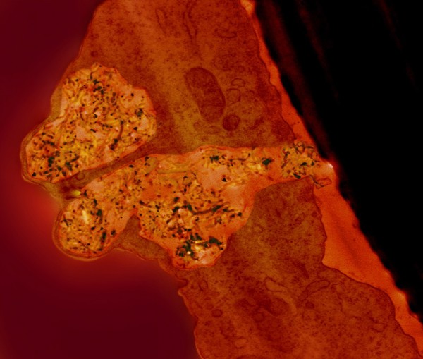 Nano-needles shuttling the blood brain barrier, TEM
