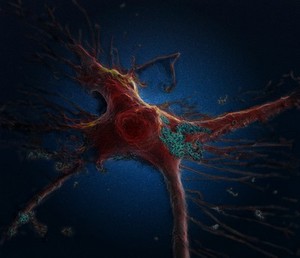 view Brain astrocyte cell taking up carbon nano-needles, SEM