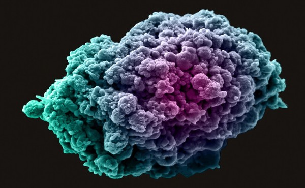 Breast cancer cell spheroid, SEM