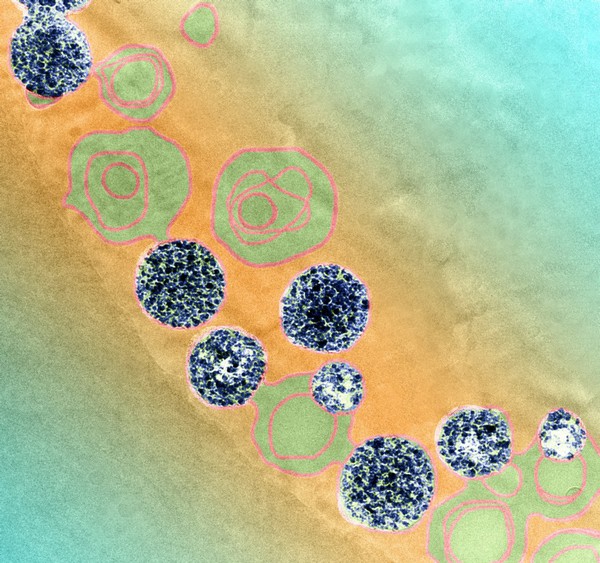 Magnetic nano-capsules, cancer imaging and therapy, cryoEM