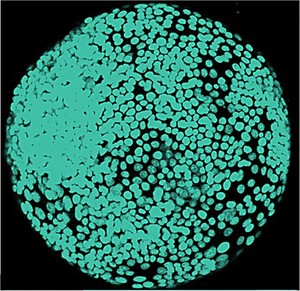 view Prostate cancer cell spheroid, LM