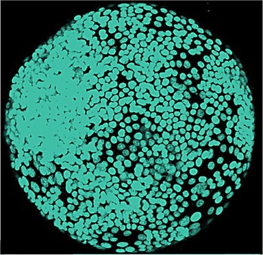 Prostate cancer cell spheroid, LM