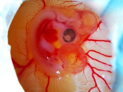 6-day old chick embryo viewed under a stereo microscope, LM