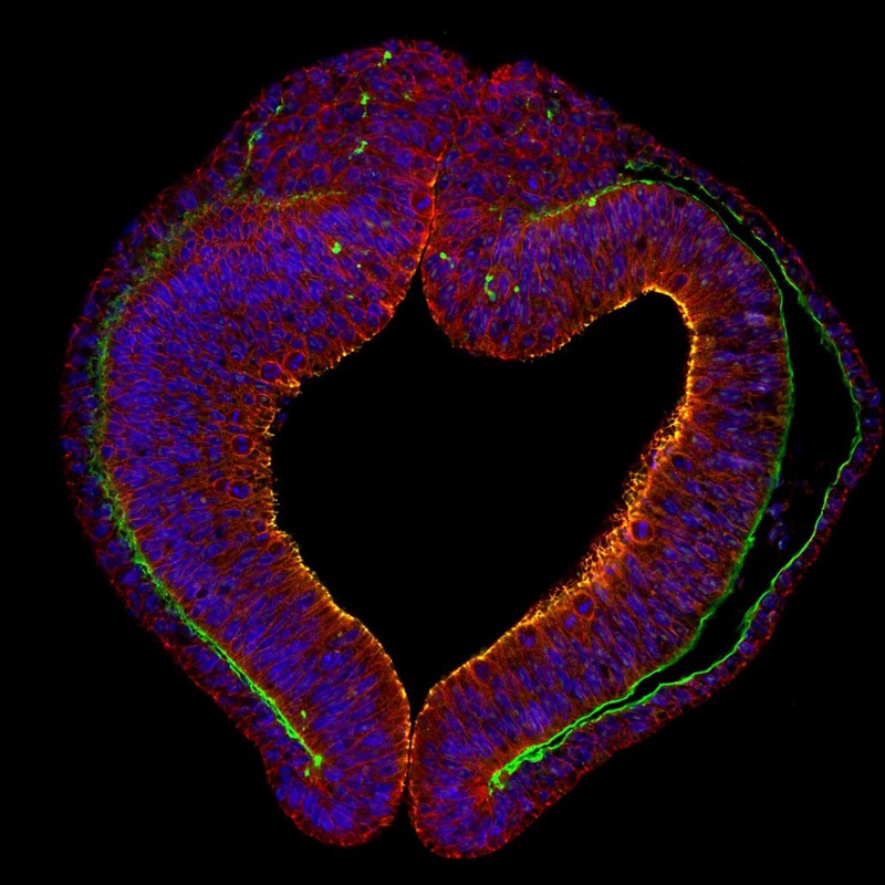 Crosssection through the optic vesicle (early eye), chick
