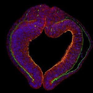 view Cross-section through the optic vesicle (early eye), chick