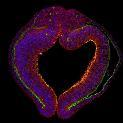 Cross-section through the optic vesicle (early eye), chick